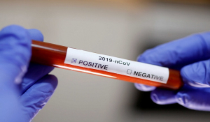 Κορωνοϊός: «Το εμβόλιο δεν θα φέρει την κανονικότητα την άνοιξη» – Νέα μελέτη σκιαγραφεί μια ζοφερή εικόνα