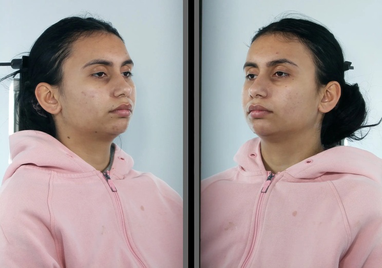 7. ΣΑΜΑΡΑ Παρασκευή 2