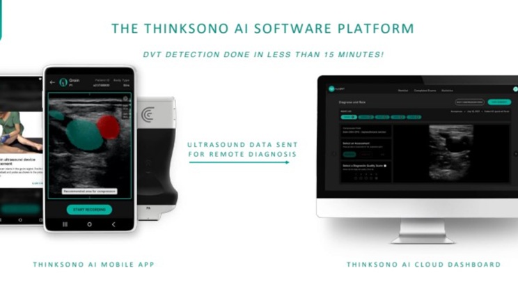 thinksono