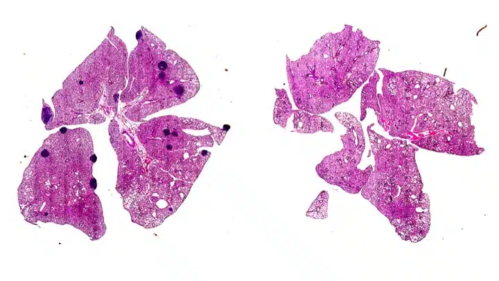 Lung metastases in mice.jpg