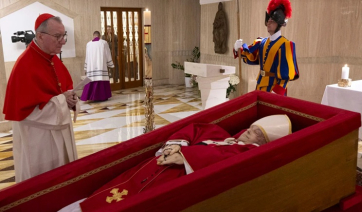 Τι συμβαίνει με τη μεγάλη μελανιά στο πρόσωπο του νεκρού Πάπα Φραγκίσκου - Τι λέει νευρολόγος