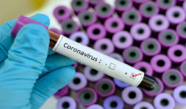 Κορονοϊός: 55 θάνατοι, 354 διασωληνωμένοι, 23.621 νέα κρούσματα