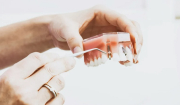 Επιστήμονες χρησιμοποιούν ανθρώπινα ούρα για να κατασκευάσουν οδοντικά και οστικά εμφυτεύματα