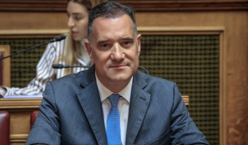 Άδωνις Γεωργιάδης: Υποβλήθηκε σε μεταμόσχευση μαλλιών
