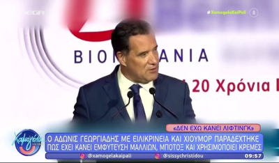 Ο Α. Γεωργιάδης με ειλικρίνεια και χιούμορ παραδέχτηκε πως έχει κάνει εμφύτευση μαλλιών (βίντεο)