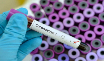 Ο κορωνοϊός είναι ο πιο θανατηφόρος σε σχέση με τους υπόλοιπους ιούς του 21ου αιώνα