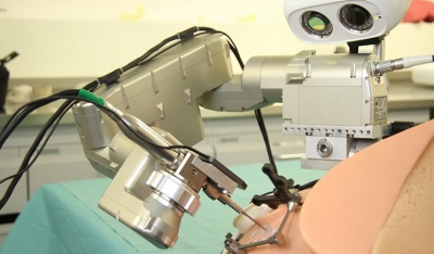 Για πρώτη φορά: Εισαγωγή κοχλιακού εμφυτεύματος σε αυτί 51χρονης κωφής με τη βοήθεια ρομπότ