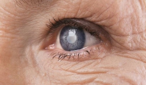 Θεραπεία βλαστοκυττάρων αποκατέστησε την όραση ηλικιωμένων