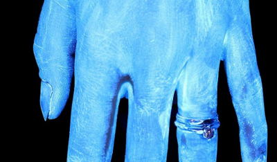 Κορωνοϊός: Φωτό με υπέρυθρες δείχνουν πώς είναι τα χέρια άπλυτα, και μετά από πλύσιμο 6, 20, 30 δευτερολέπτων