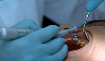 Κορωνοϊός: Έτσι θα πηγαίνουμε στα οδοντιατρεία - Πότε χρειάζεται rapid test