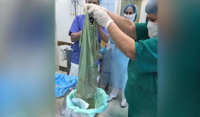 Απίστευτο: Ρώσοι γιατροί έκαναν καισαρική αλλά ξέχασαν... σεντόνι στην κοιλιά της μητέρας!