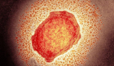 Ισπανία: Ερευνητές προσδιόρισαν την πλήρη αλληλουχία του ιού της ευλογιάς των πιθήκων – Στα 84 τα κρούσματα
