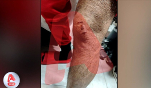 Ληστεία με πίτμπουλ - Γροθιές και δαγκωνιές στην Ομόνοια (βίντεο)